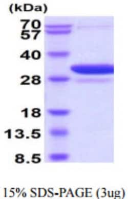 Novus Biologicals&trade;&nbsp;Human 14-3-3 beta/alpha Recombinant Protein